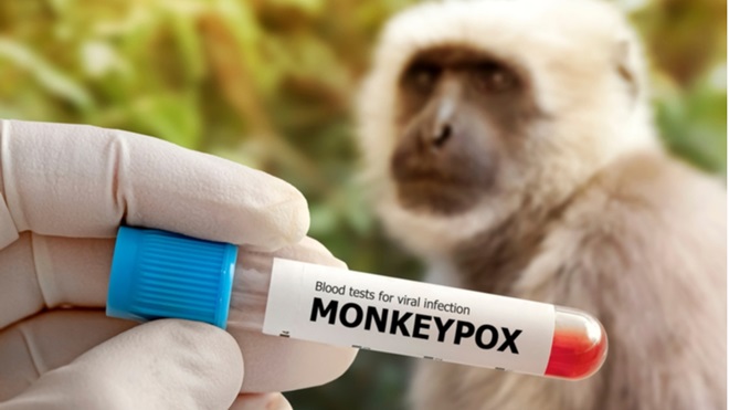 Il vaiolo delle scimmie - Come vaccinarsi