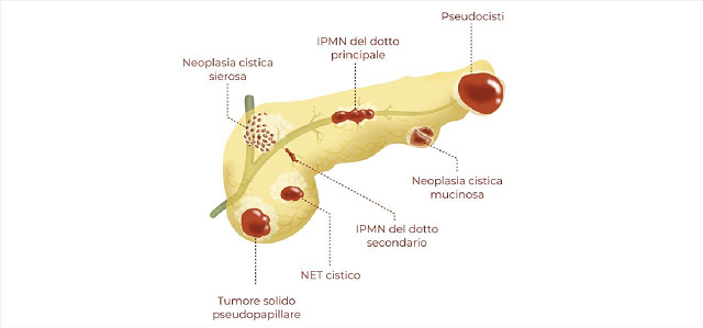 cisti1234